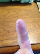 Sharp Edges Healed